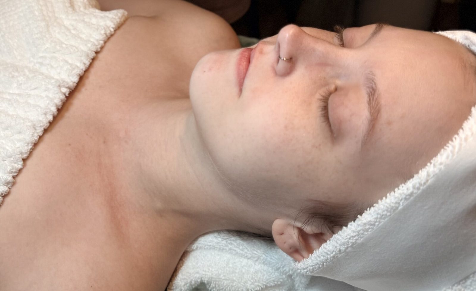 Medical-grade peel and microneedling treatment room at Serene Med Spa Paintsville
