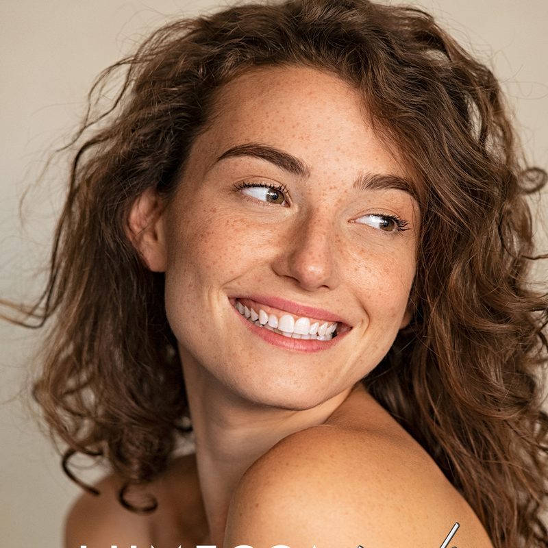 Clear, even skin after Lumecca IPL photofacial